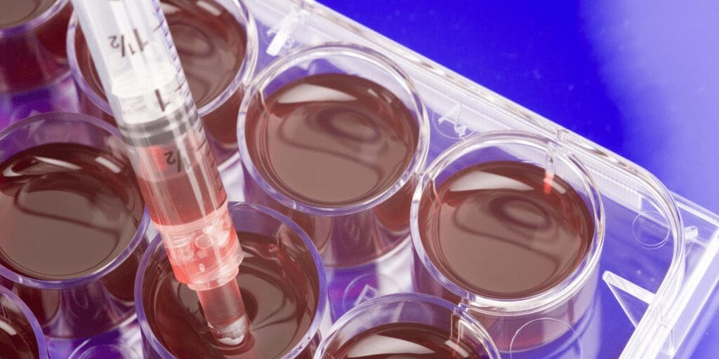 how does stem cell work