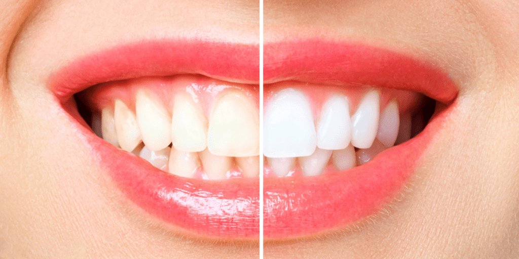teeth