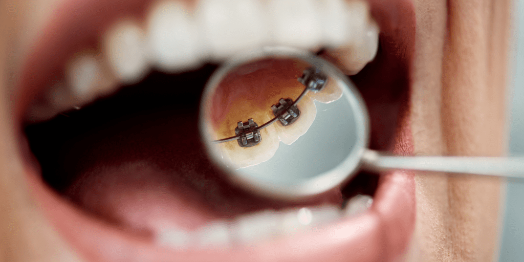 orthodontist
